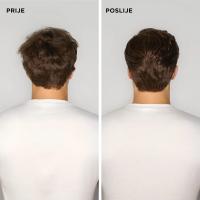 Prije i poslije upotrebe Paul Mitchell Clear šampona.