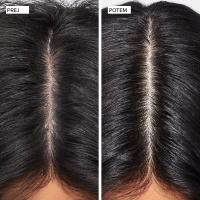 CLEAN BEAUTY SCALP CARE KOMPLET S KRTAČO - 4