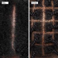 Scalp Therapy – pred in po uporabi za bolj zdravo lasišče