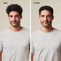 MITCH Reformer – pričeska prej in potem