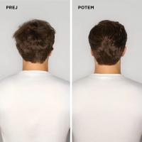 Prej in potem uporabe Paul Mitchell Clear šampona