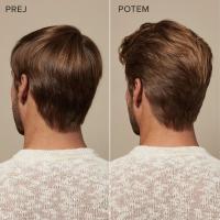 Scalp Care Anti-Thinning Conditioner – rezultat prej in potem