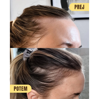serum HRS Hair Syrup - Growsmary Oil