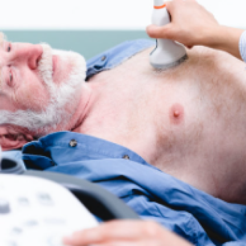 Heart Ultrasound