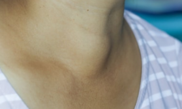 How do we identify thyroid problems?
