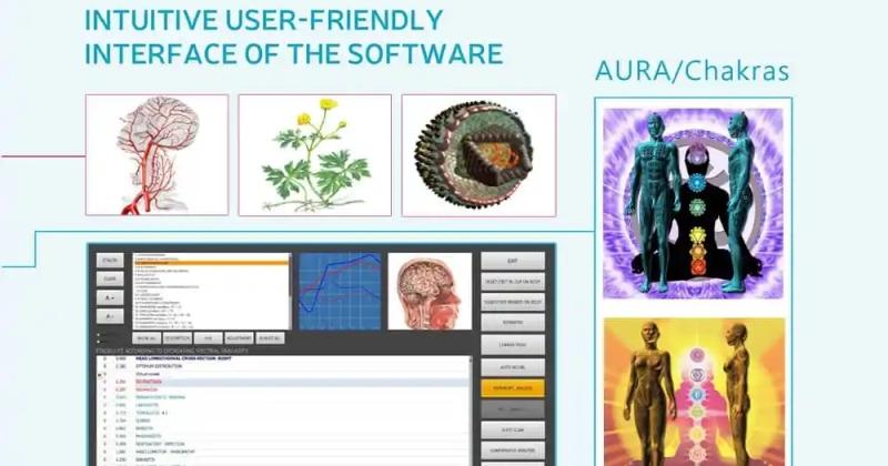Frekvenčna diagnostika