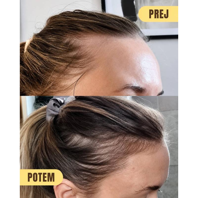 serum HRS Hair Syrup - Growsmary Oil